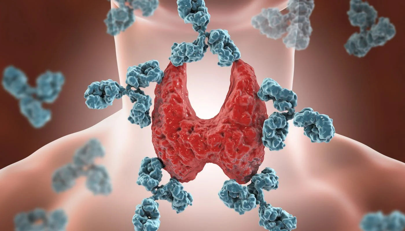 Tiroiditis de hashimoto